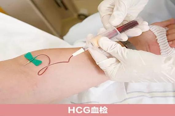 广州三代供卵试管代怀【广州三代供卵试管代怀:新生命的传承】